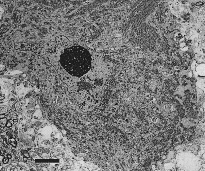 EGM Graph of a cat with SMA 